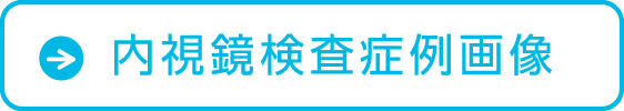 内視鏡検査症例画像